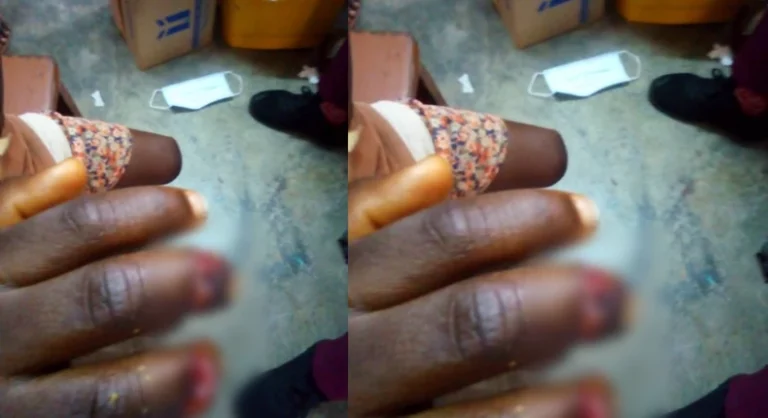 Lactating Mother Chops Off 5-Year-Old Boy's Fingers For Allegedly Stealing Fish From Soup